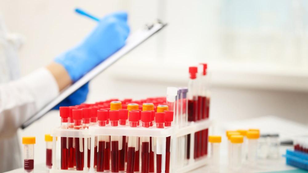KANLA BULAŞAN PATOJENLER – İş Sağlığı ve Güvenliği Ödevleri – İş Sağlığı ve Güvenliği Tez Yaptırma – İSG – İş Sağlığı ve Güvenliği Tez Yaptırma Ücretleri